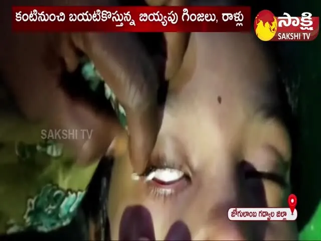 Rice Grains Coming From The Girl Eyes At Manavapadu In Jogulamba Gadwal District