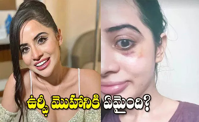 Urfi Javed shares photo of bruises Goes Viral On Social Media - Sakshi