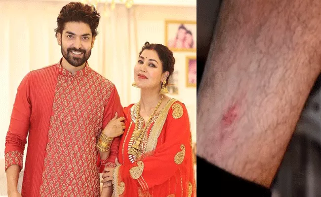 Gurmeet Choudhary Injured While Protecting Debina Bonnerjee, Video Goes Viral - Sakshi