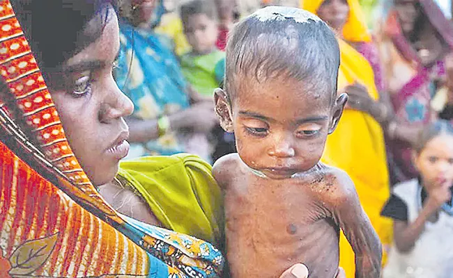 Malnutrition In Children 1-20 Lakh People Identified In Telangana - Sakshi