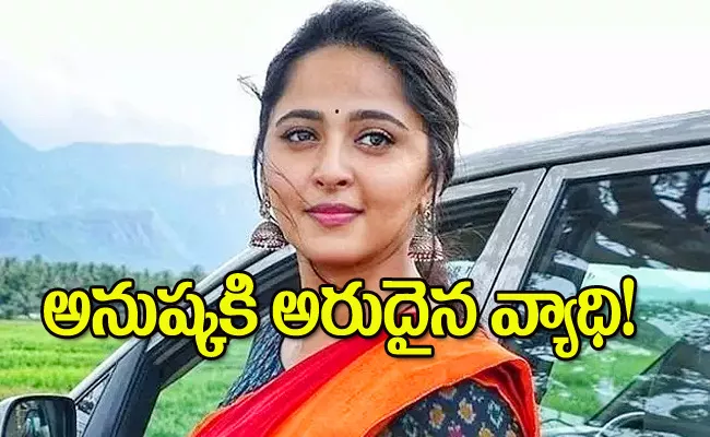 Anushka Shetty Suffered With a Rare Disease - Sakshi