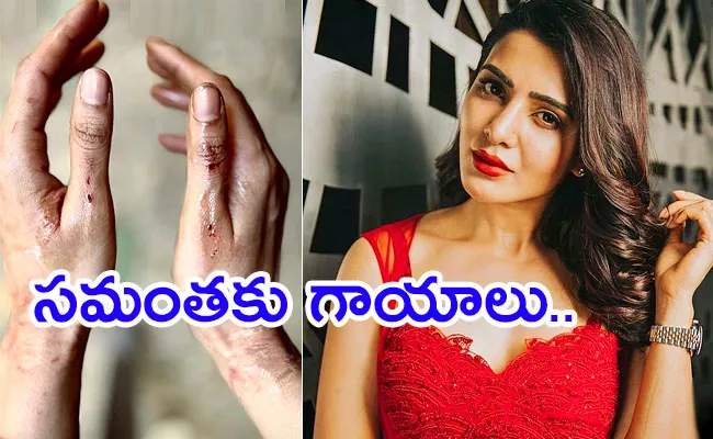 Samantha Injured in Citadel Movie Shooting Set - Sakshi