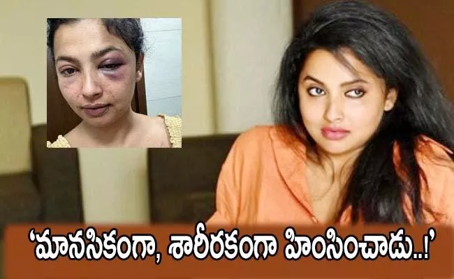 Tamil Actress Anika Vijay Vikraman Abused by Boyfriend Shares Photos on Instagram - Sakshi