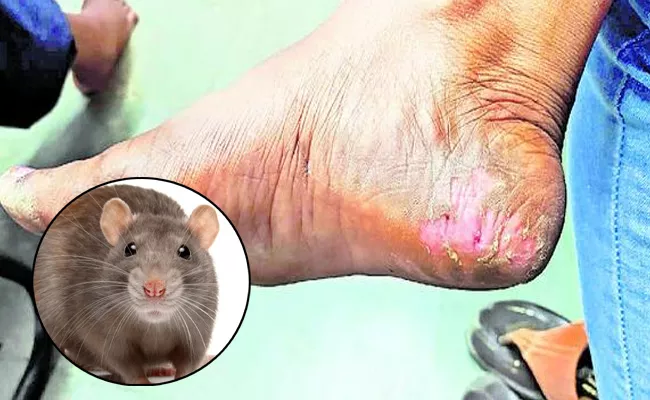 Rats Bite Students In warangal - Sakshi