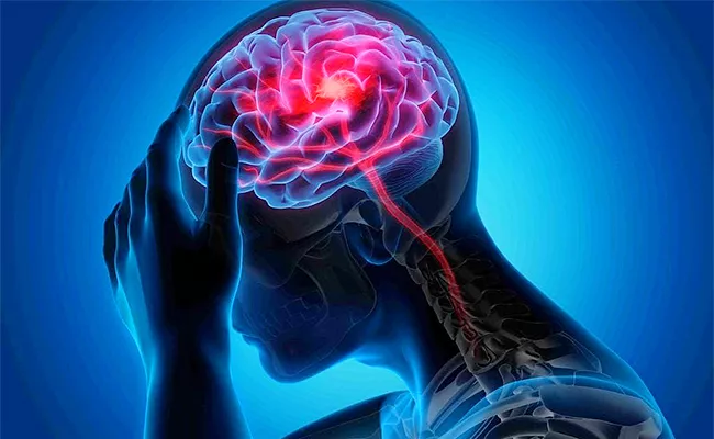 Nasal Drops Treatment Could Lead To Quick Recovery From Stroke - Sakshi