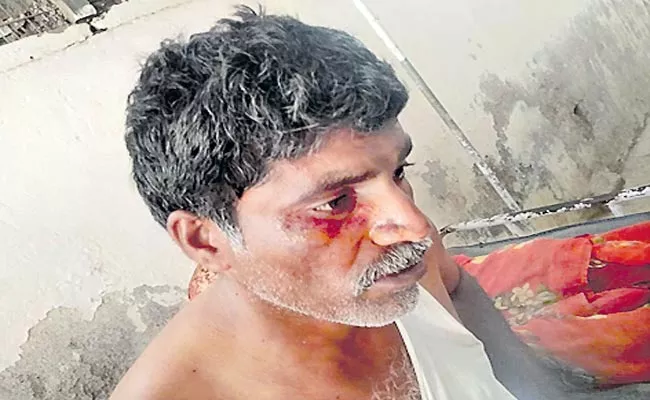 Tdp Activists Attack On Ysrcp Karyakartha Prakasam - Sakshi