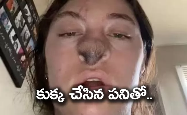 Dog Bite Girls Nose, After Treatment Hair Growing On Her Face - Sakshi