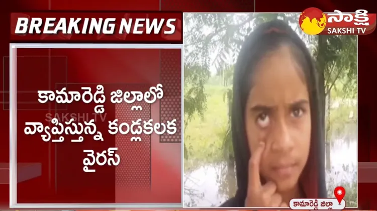 Conjunctivitis Tension In Kamareddy District 