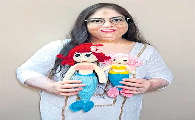 I Lost My Confidence to Vitiligo but Crafting Toys Saved Me! - Sakshi