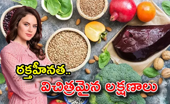 What Is Anemia, Causes And Foods To Prevent It - Sakshi