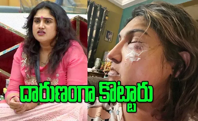 With Bigg Boss Issue Unknown Person  Attack To  Vanitha Vijayakumar - Sakshi