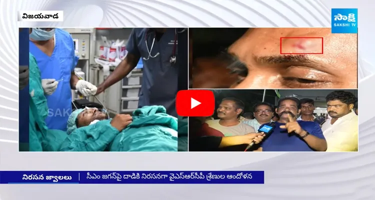 YSRCP Followers Denied CM Jagan Stone Hit Incident 