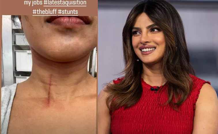 Priyanka Chopra Get Injured On The Sets Of Bluff