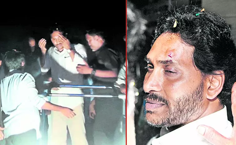 Chandrababu Spreading Fake Propaganda On Jagan Reddy Stone Pelting