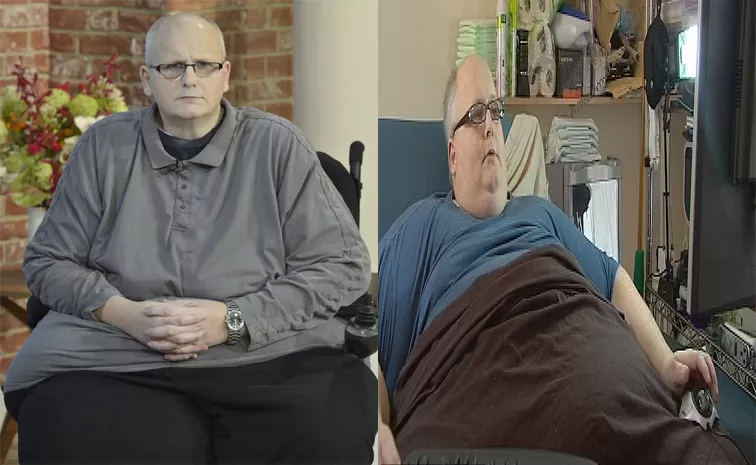 Worlds Heaviest Man Loses Weight But May Never Walk Again