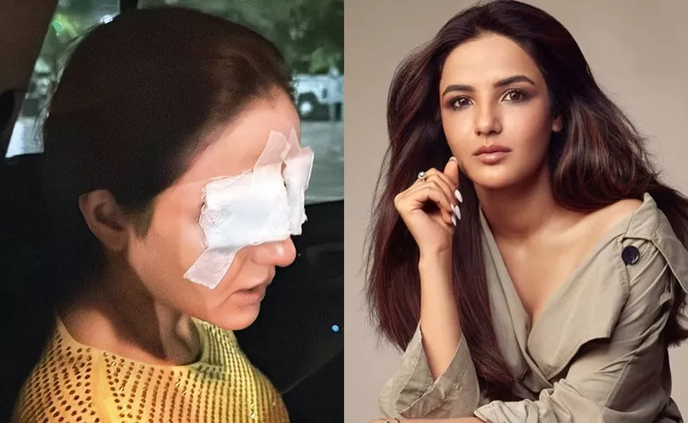 Actress Jasmin Bhasin Lens Issue With Eye Sight