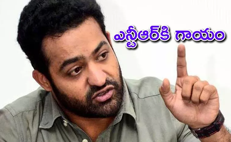 Actor Jr Ntr Hand Injury Latest News