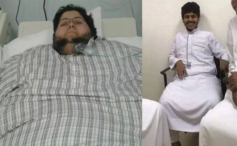 Saudi Mans Incredible 542 kg Weight Loss