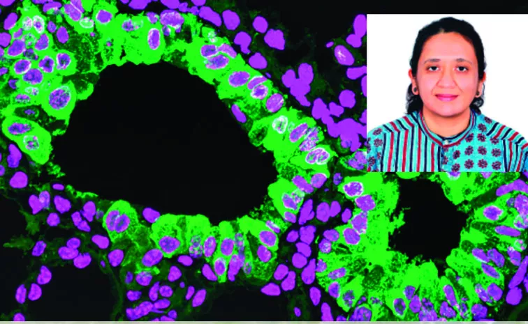 new genetic defect is serpinopathy