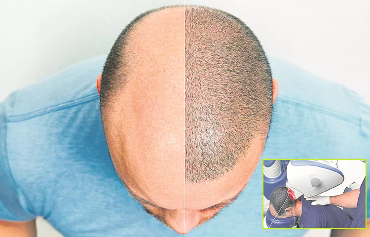 If Care Is Not Taken In Treating Hair Loss There Are Complications