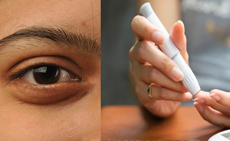 do you know Diabetes disease and eye symptoms