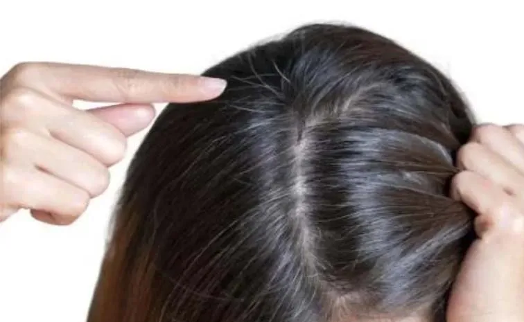 Premature Gray Hair: Causes And Prevention