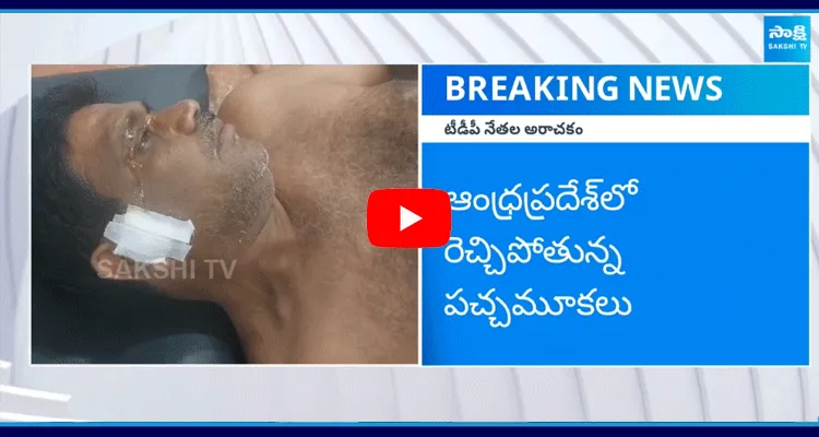 TDP Leaders Attack On YSRCP Worker In Nandyalampalle