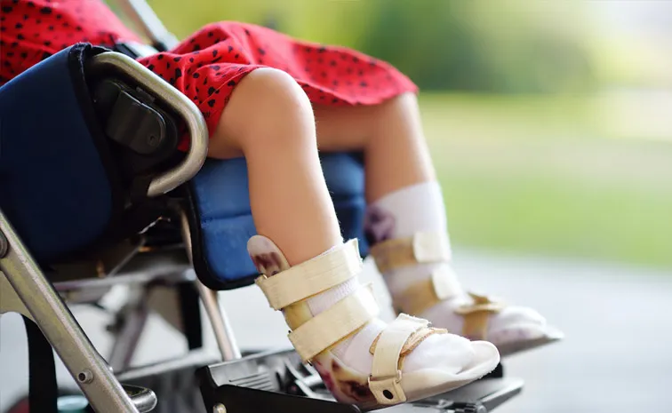 Know about Cerebral Palsy Symptoms