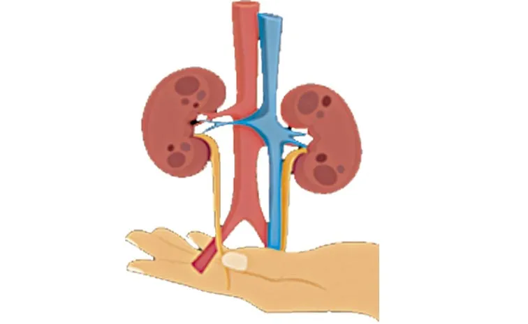 422 kidney transplant cases in Andhra Pradesh