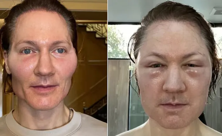 Tech Millionaire Bryan Johnson Face Blows Up After Anti-Ageing Experiment Goes Wrong