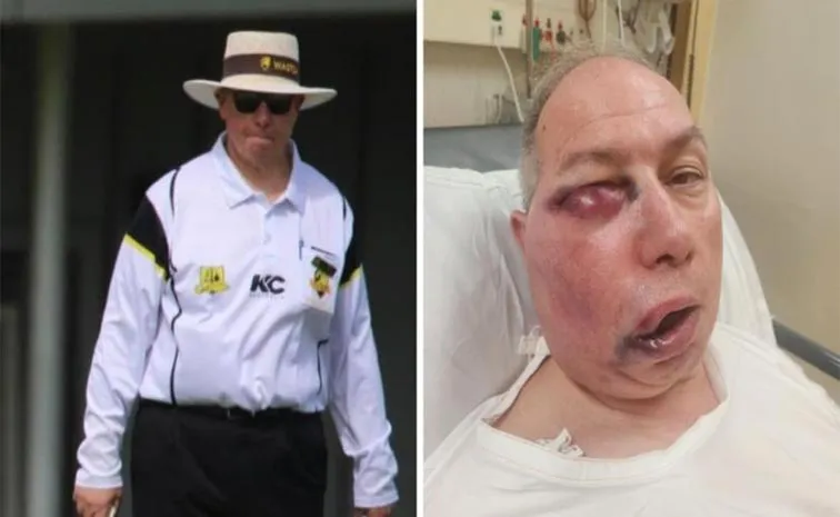 Cricket Umpire Gets Seriously Hurt With A Straight Drive