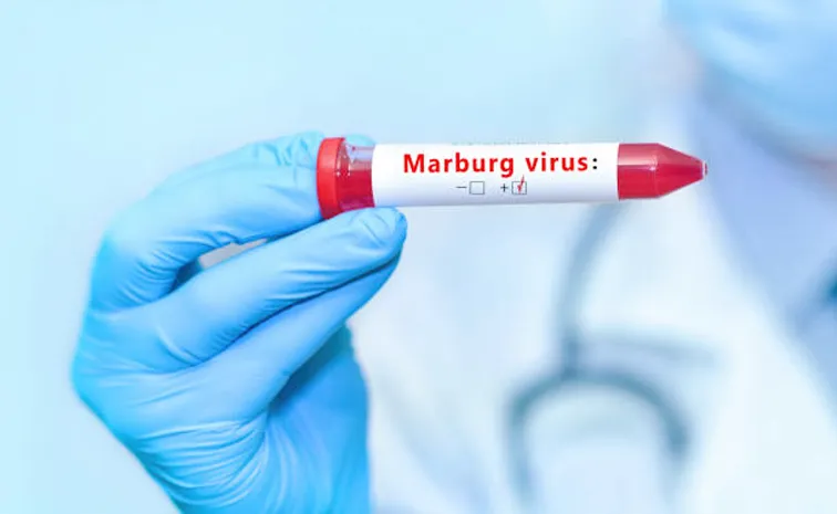 Urgent Warning Issued to UK and Africa Travelers Over Deadly Marburg Disease