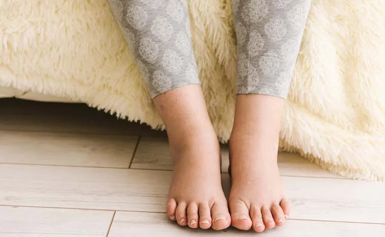 These Ways To Manage Swollen Legs And Feet During Pregnancy