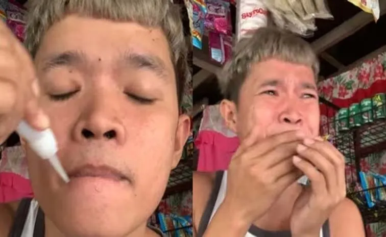 Man's Superglue Prank Goes Wrong Seals His Lips Goes Viral