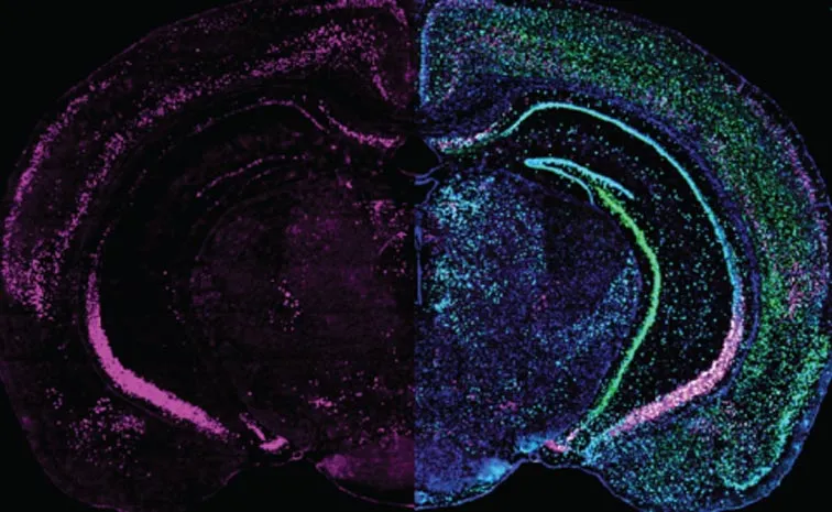 Scientists discover brain mechanism that helps overcome fear