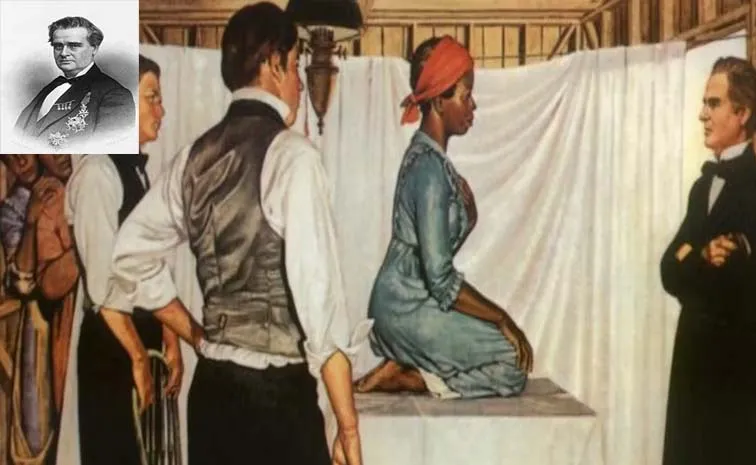 Father of Gynecology: Experimented on Black Women Without Anesthesia