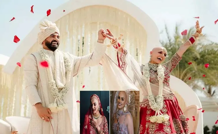 Indian Bride Embraced Her Alopecia Ditched Wigs On Wedding Day