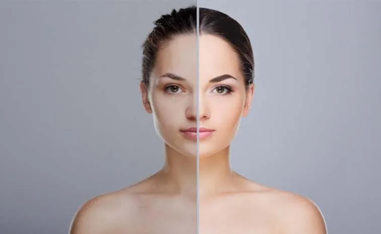 Skin Pigmentation Types Causes And Treatment