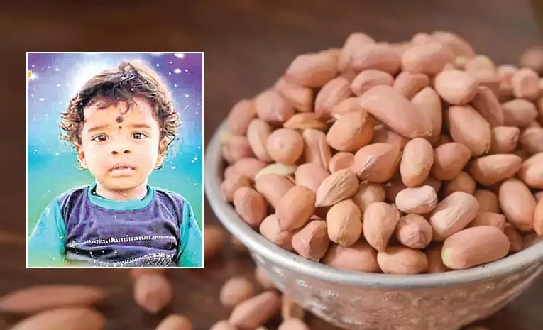 Boy Dies After Peanut Gets Stuck in Throat