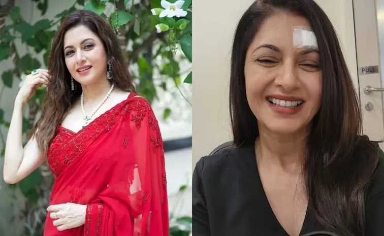 Bhagyashree Injured in Pickleball Game, gets 13 Stitches