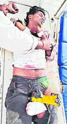 తెనాలి వైద్యశాలలో అరుదైన సర్జరీ