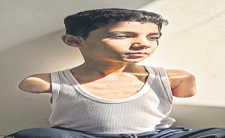 Portrait of injured Gaza boy named press photo of the year