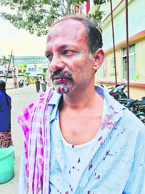 వైఎస్సార్ సీపీ సానుభూతిపరుడిపై టీడీపీ శ్రేణుల దాడి