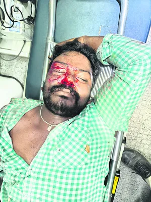 వేర్వేరు రోడ్డు ప్రమాదాల్లో ఇద్దరికి తీవ్ర గాయాలు