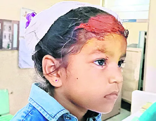 చిన్నారిపై వీధి కుక్క దాడి
